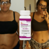 contrave-weight-loss-pills-6-510x340 Contrave for Weight Loss